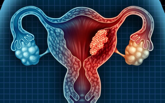 Endometrial-843358252-e1756321381912