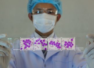 Diversitatea Celulelor Stem în Leucemie Accentuează Rezistența la Tratament în AML 0 (0)