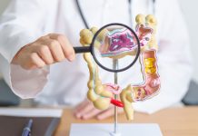 Cum scapă tumorile colorectale de inhibiția KRAS