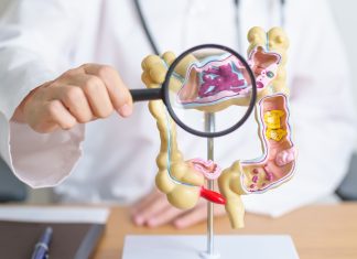 Cum scapă tumorile colorectale de inhibiția KRAS 0 (0)