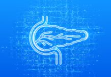 Inteligența Artificială REDMOD de la Mayo Clinic Dublează Sensibilitatea Detectării Precoce în Cancerul Pancreatic