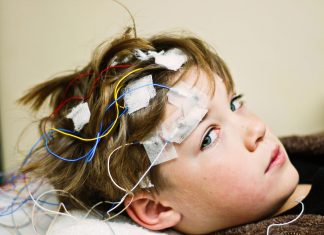 Recomandare pentru Screening-ul Autismului la Copiii cu Epilepsie 0 (0)