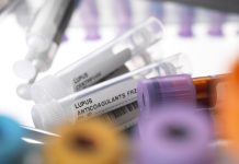 Harta Imunității Dezvăluie Legături Genetice Specifice Sexului în Bolile Autoimune