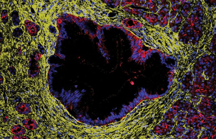 PanINmicroenvironment-small