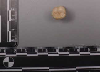 Proteina din dinții Homo erectus indică un schimb genetic cu Denisovanii 0 (0)