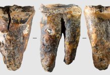 Neanderthalienii tratatu durerile dentare acum 59.000 de ani