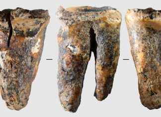 Neanderthalienii tratatu durerile dentare acum 59.000 de ani 0 (0)
