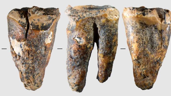 molar-1152x648