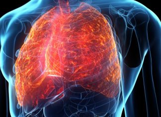 O tehnică de imagistică poate diferenția inflamația pulmonară de fibroză 0 (0)