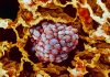 Sistemul AI depășește PD-L1 în prezicerea rezultatelor imunoterapiei în cancerul pulmonar