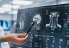 Medicamentul anti-convulsiv ar putea încetini tumori cerebrale agresive la copii