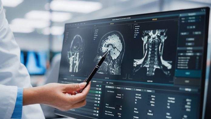 Aug1_2025_GettyImages_1388387927_NeurologistMedicalDisplay