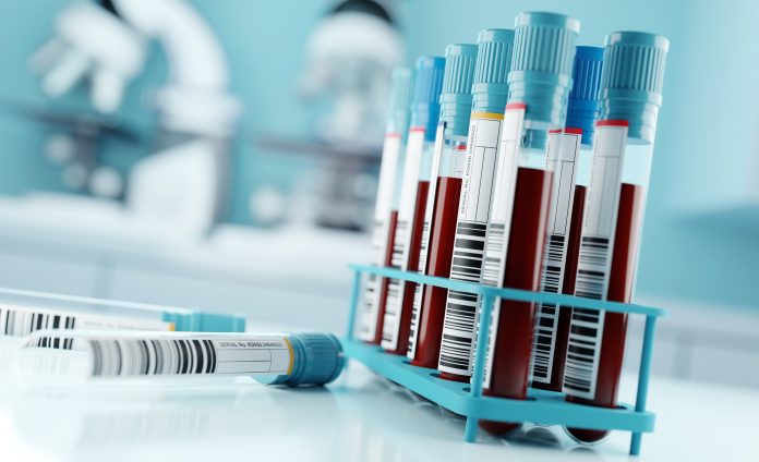 Blood-Samples-1300036735