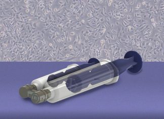 Un nou dispozitiv MIT ar putea transforma depistarea precoce a cancerului ovarian 0 (0)