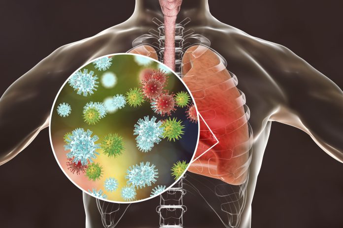 Viral-Pneumonia-1042128550