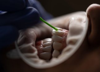 Analiza izotopică: Cum pot dinții unei mumii să ne spună unde a copilărit acea persoană.