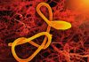 Epoca post-antibiotice: Cum luptăm cu super-bacteriile rezistente la medicamente?