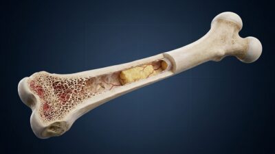 Bone-structure-400x225