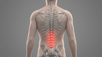 Inflamed-lower-back-discs-400x225