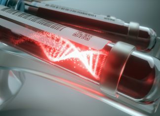 O analiză revoluționară a sângelui ar putea ajuta la depistarea tipurilor de cancer pulmonar cu celule mici 0 (0)