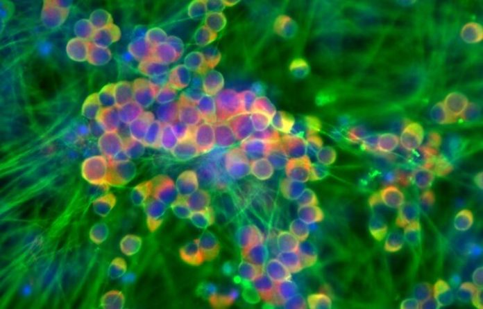 Pain-receptor_neurons-e1791299776447