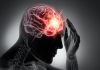 Un test de sânge promite să detecteze leziuni cerebrale invizibile la tomografie