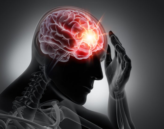 Traumatic-Brain-Injury