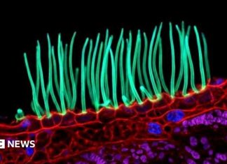 O imagine microscopică stârnește controverse în competiția Nikon din cauza inteligenței artificiale 0 (0)